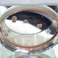 Organoid