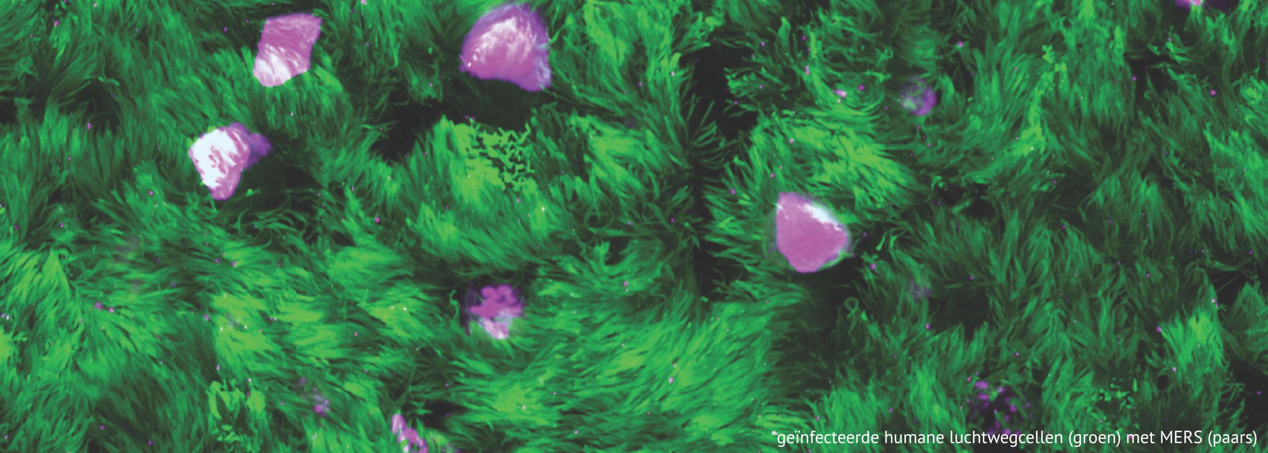 mers virus